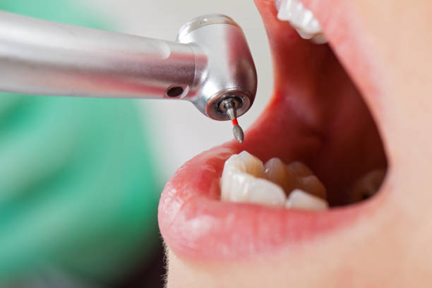 Best Broken or Cracked Tooth Emergency Dentist in Roslyn Heights, NY